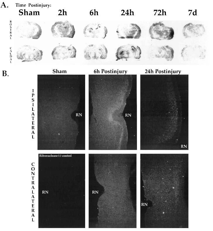 FIG. 1